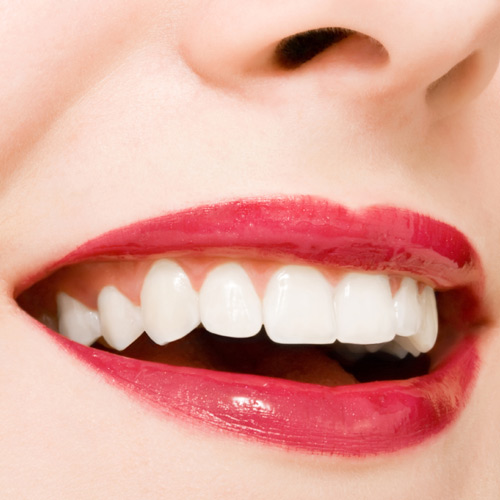 Bọc răng sứ cho răng sâu 3