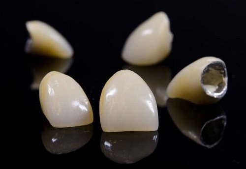 Độ bền của các loại răng sứ