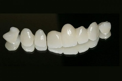 Độ bền của các loại răng sứ