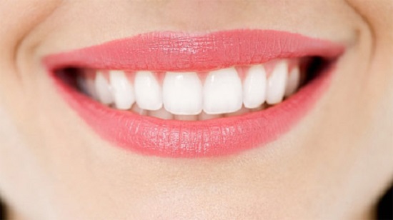 Tẩy trắng răng công nghệ Laser Whitening 1