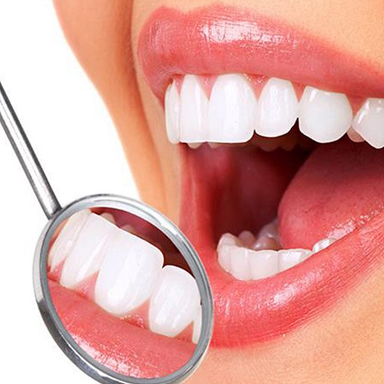 Tẩy trắng răng công nghệ Laser Whitening 3