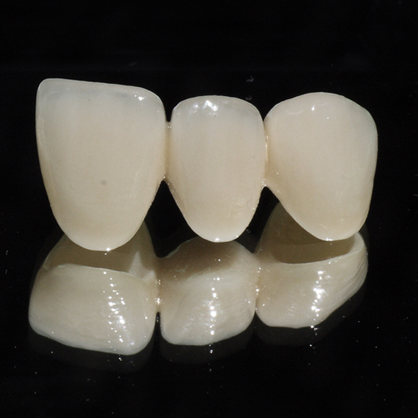 Những ưu điểm của răng sứ Zirconia