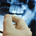 Quy trình của một ca niềng răng mắc cài 3M UGSL