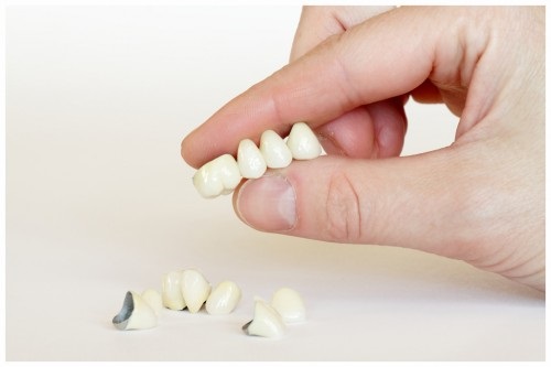 Cách bảo quản và giữ gìn răng sứ lâu bền nhất-2 Cách bảo quản và giữ gìn răng sứ lâu bền nhất
