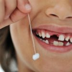 Cách nhổ răng sữa đúng thời điểm cho trẻ