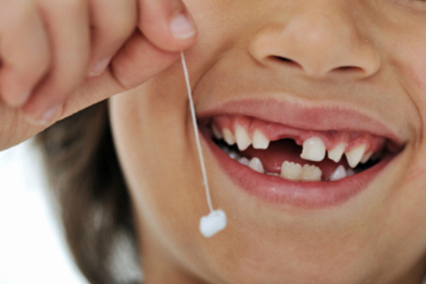 Cách nhổ răng sữa đúng thời điểm cho trẻ