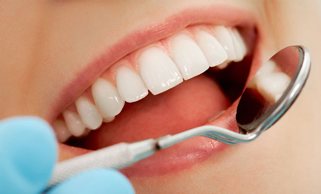 Cạo vôi răng có gây chảy máu không?