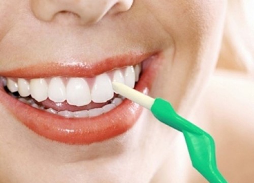 Cạo vôi răng tốt hay xấu?