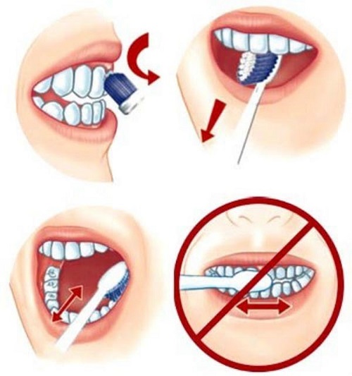 Lý do khiến bạn đánh răng mãi không sạch?
