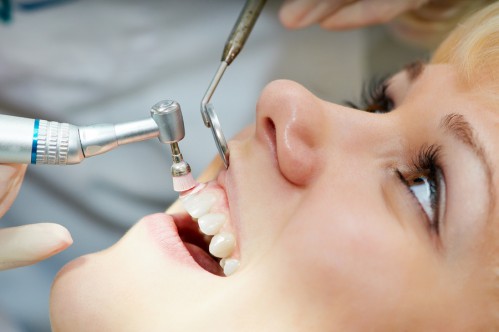 Những câu hỏi thường gặp về tẩy trắng răng