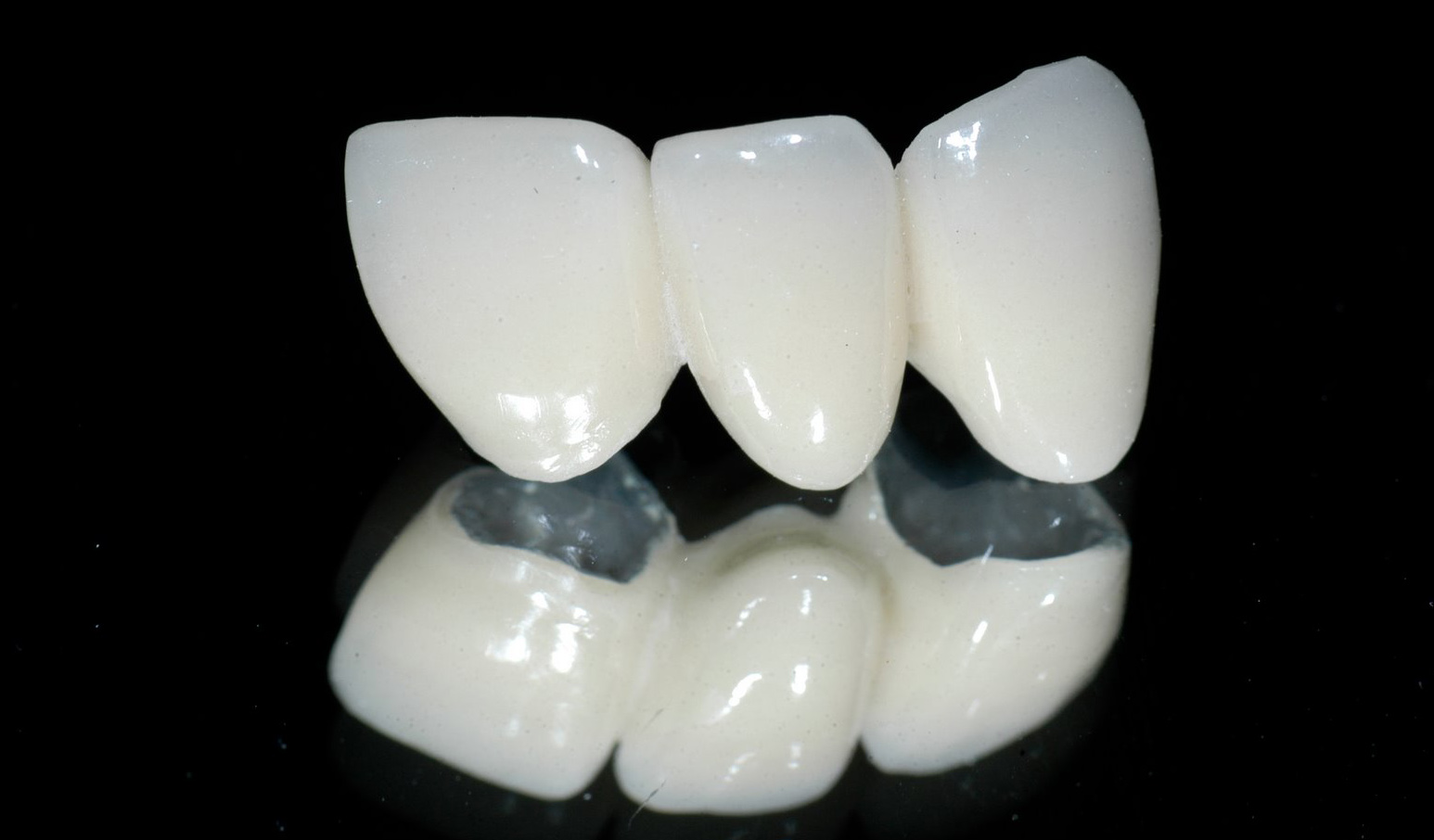 Những đặc điểm của răng sứ toàn sứ