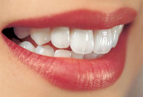Những đặc điểm của răng sứ toàn sứ