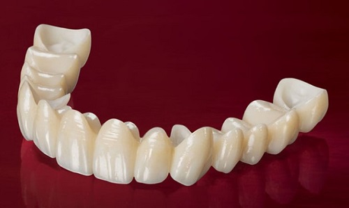 Răng sứ Cercon có màu giống răng thật