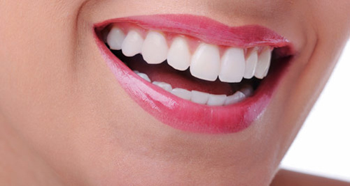 Tại sao răng toàn sứ lại có giá cao?