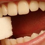 Thời gian tẩy trắng răng mất bao lâu?