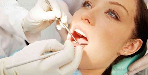 Quy trình thực hiện bọc răng sứ cho răng hàm 2