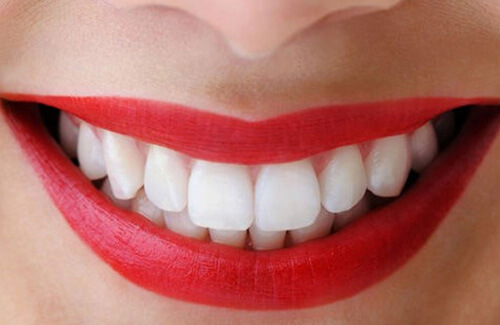 Bọc răng sứ cho răng khập khểnh như thế nào? 3