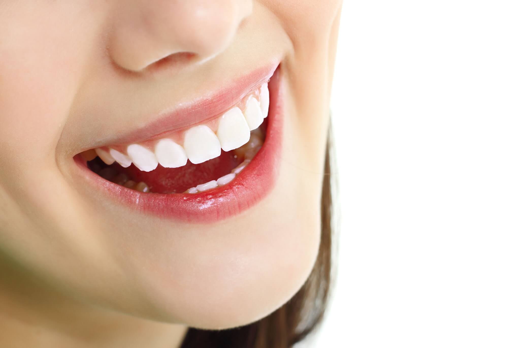 Quá trình thực hiện bọc răng sứ có lâu không? 3