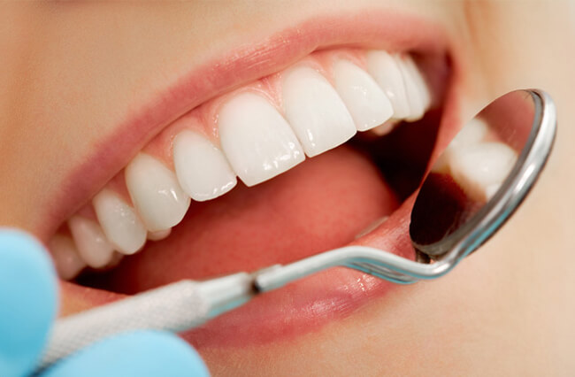 Bọc răng sứ cho răng bị thưa đẹp tự nhiên tại nha khoa 3