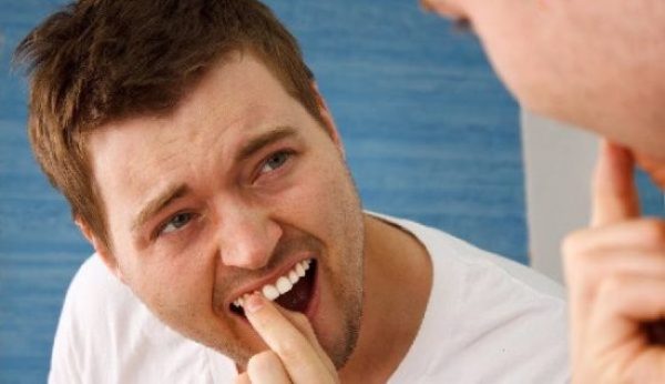 Răng bọc sứ bị lung lay phải làm sao? Cách khắc phục 1