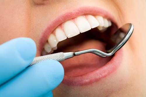 Nhổ răng khôn có đau không? Tham khảo ý kiến bác sĩ 3