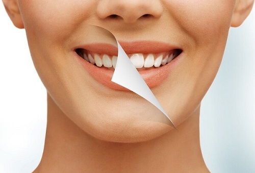 Tẩy trắng răng không nên ăn gì?