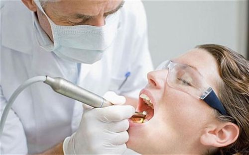 Tẩy trắng răng có hại không? 3