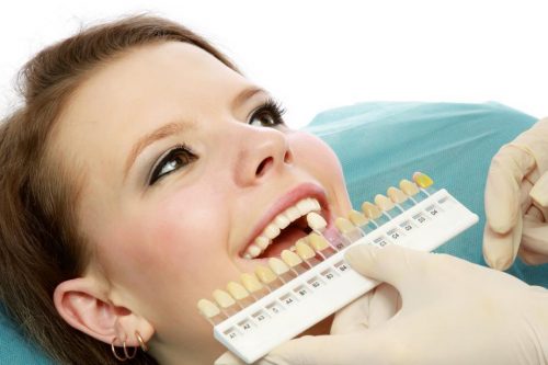 Tẩy trắng răng bằng laser whitening có hại không? 2