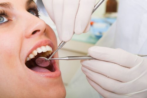 Nhổ răng khôn hàm dưới có nguy hiểm không? 2