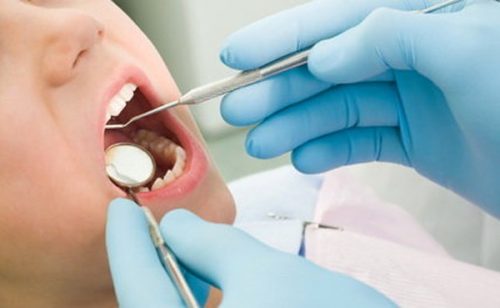 Nhổ răng sâu ở đâu an toàn? 4
