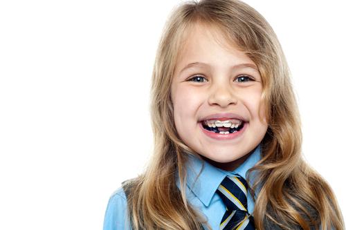 Niềng răng cho trẻ em cần phải biết những kiến thức nào? 1
