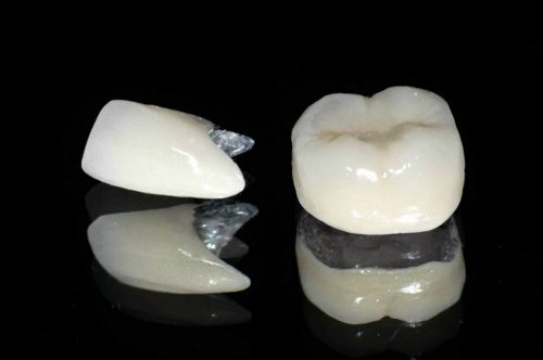 Bọc răng sứ có bền không? Cách chăm sóc sau bọc răng 1