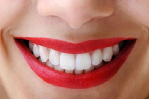 Bọc răng sứ zirconia vì sao được nhiều người lựa chọn?-1 Bọc răng sứ zirconia vì sao được nhiều người lựa chọn?