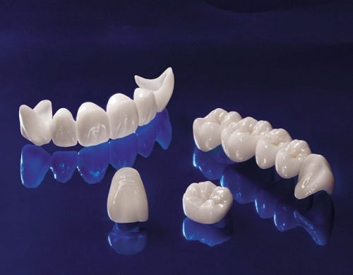 Giá bọc răng sứ zirconia tại nha khoa đạt chuẩn 2