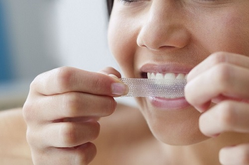 Miếng dán tẩy trắng răng có thực sự hiệu quả? 2