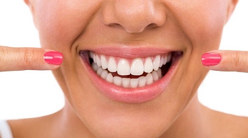 Vì sao nên thực hiện niềng răng hô hàm trên? 1