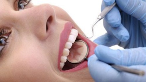 Niềng răng invisalign tại nha khoa Đăng Lưu 3