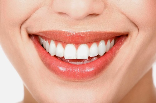 Niềng răng rẻ nhất là bao nhiêu tại địa chỉ nha khoa uy tín? 1