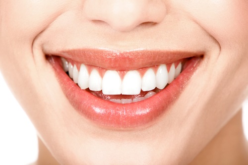 Tẩy trắng răng bằng đèn plasma có hại không với tuổi 16? 1
