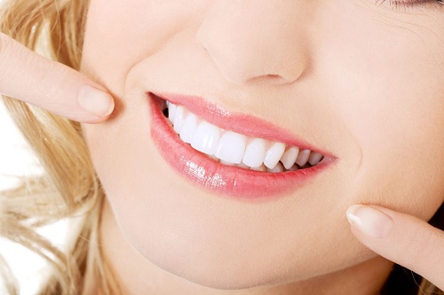 Theo bạn có nên tẩy trắng răng nhiều lần không? 2 Theo bạn có nên tẩy trắng răng nhiều lần không? 2
