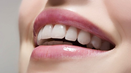 Làm răng sứ không mài răng cho trường hợp nào? 2