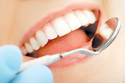 Làm răng sứ không mài răng cho trường hợp nào? 3