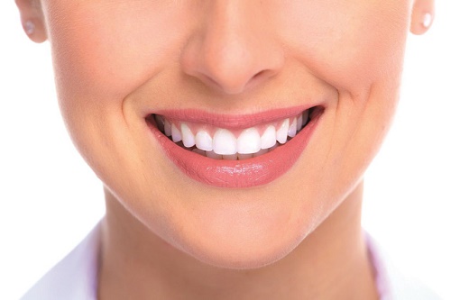Răng sứ veneer có tốt không? Áp dụng cho các trường hợp nào? 3