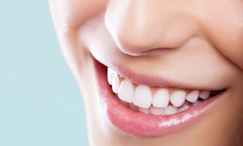 Răng sứ có bền không? Cách chăm sóc răng sứ bền đẹp 1