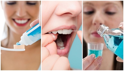 Răng sứ có bị sâu không? Cần lưu ý gì trong việc chăm sóc? 3