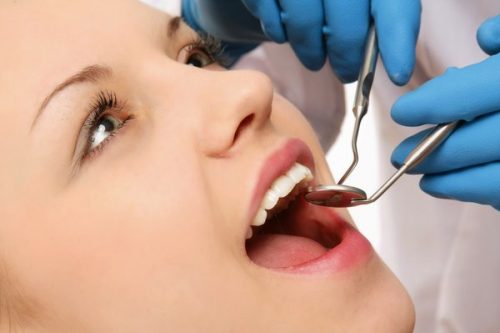 Chữa viêm chân răng bằng thuốc nam hiệu quả không? 4