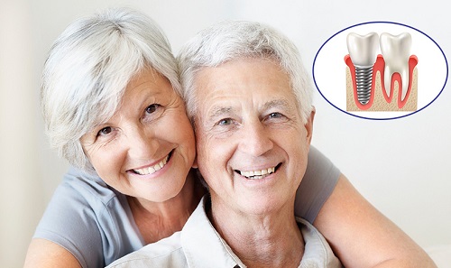 Trồng răng giả cho người già với phương pháp nào? 2