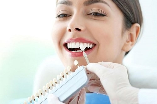 Trồng răng khểnh có đau không? Tham khảo tư vấn 3