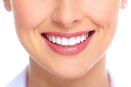 Niềng răng xong có nên tẩy trắng răng không? 3