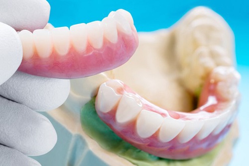 Vệ sinh răng giả tháo lắp - Nha khoa chia sẻ 3
